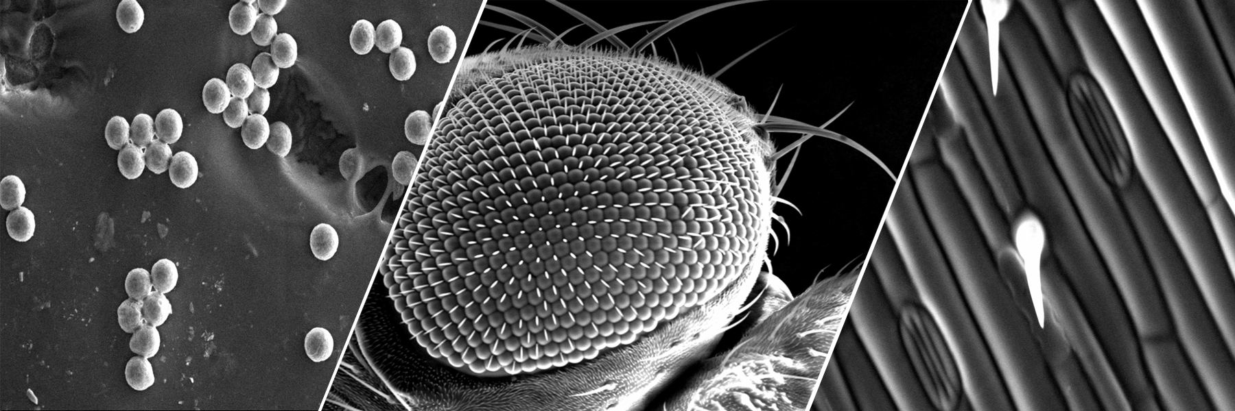 SCANNING ELECTRON MICROSCOPE